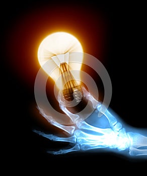 X-ray hand with bulb
