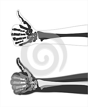 X-ray hand