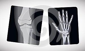 X-ray of the hand and foot. Vector