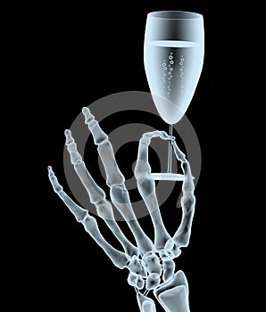 X-ray hand with glass of wine