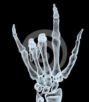 X-ray hand making offensive gesture