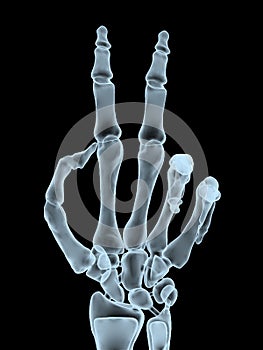 X-ray hand making victory gesture