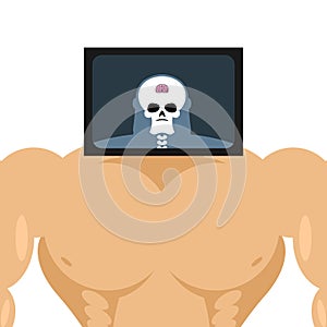 X-ray head bodybuilder. large muscles and small brain. Structure