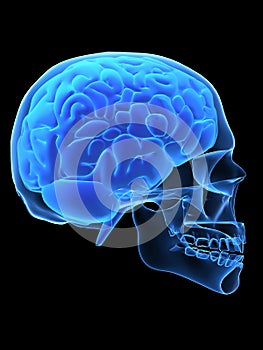 X-ray head with brain