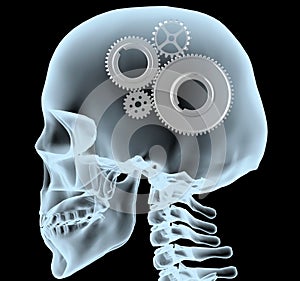 X-ray of a head with the gears instead of the brain
