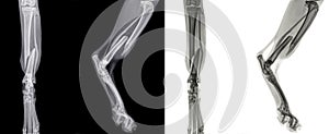 X ray of the  hind leg of a cat with a fracture of the shinbone tibia