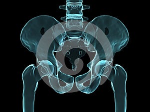 X-ray hip