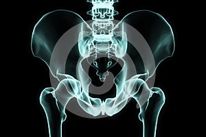 X-ray hip