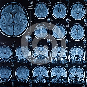 The X-ray of the human brain