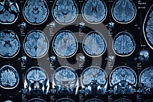 The X-ray of the human brain