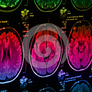 The X-ray of the human brain