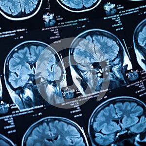 The X-ray of the human brain