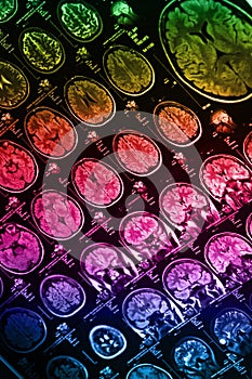 The X-ray of the human brain