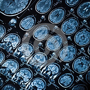 The X-ray of the human brain