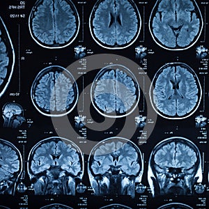 The X-ray of the human brain