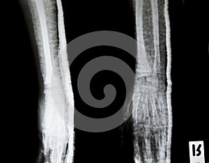 X-ray of human hands.