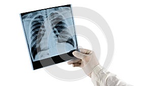 X-ray of a human lung is isolated on a white background  the doctor analyzes the X-ray of the lungs