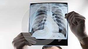 X-ray of human lungs on a white background at a doctor in the hands of an X-ray lung