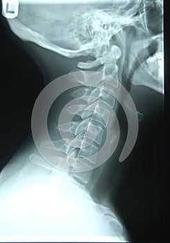 X-ray of human neck