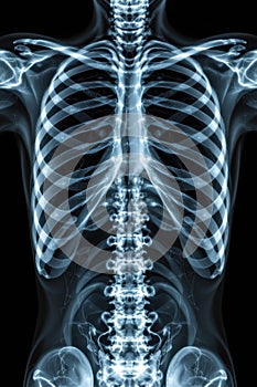 x ray of human rib cage with clear visualization of lungs cavity and sternum alignment photo