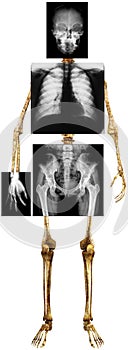 X-Ray Human Skeleton Body Isolated