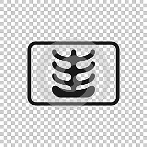 X-ray icon in flat style. Radiology vector illustration on white isolated background. Medical scan business concept