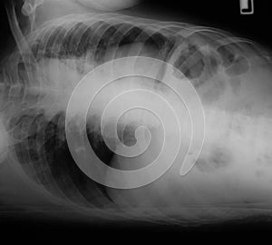 X-ray image of chest.