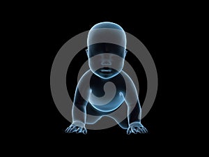 x-ray image of crawling baby.