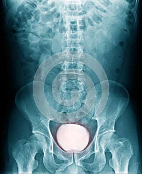 X-ray image full blader