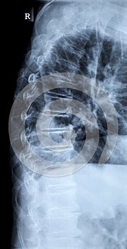 X-ray image of a human adult backbone