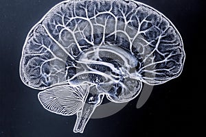X-ray image of the human brain