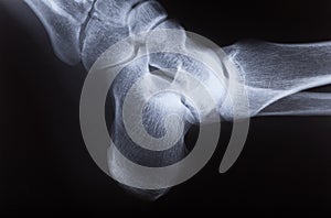 X-ray image of human foot joint , side view