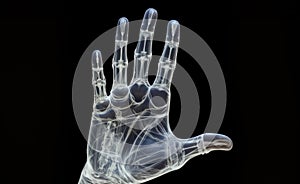 X-Ray Image of a Human Hand with Visible Bones