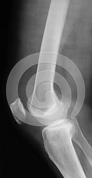 X-ray image of knee joint.