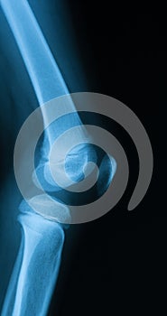 X-ray image of knee joint.