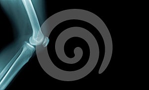 X-ray image knee joint with banner design