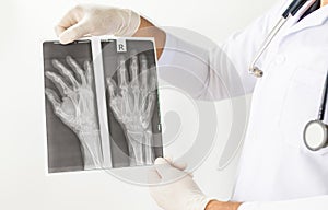 X-Ray image of human hands,Doctor examining a lung radiography, Doctor looking chest x-ray film,Anatomy.