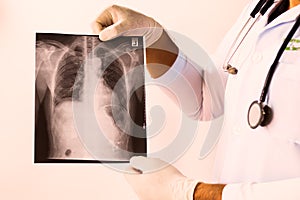 Doctor examining a lung radiography, Doctor looking chest x-ray film,Anatomy.