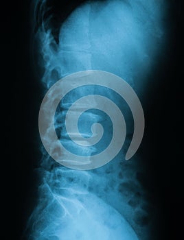 X-ray image of lumbar spine.