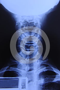 X-ray image neck