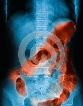 Immagine da ordinario gonfiarsi sdraiato sulla schiena 