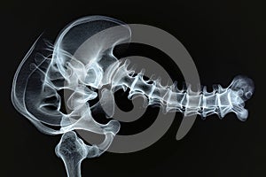 This x-ray image provides a detailed view of a human skeleton, showcasing the various bones, joints, and the spine, X-ray film of