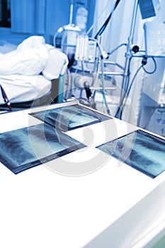 X-ray images on the background of hospital ward
