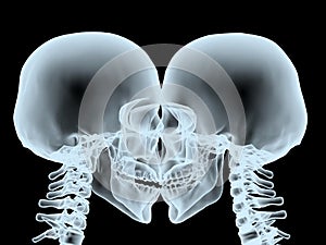 X-Ray kiss close up