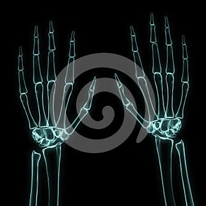 X-ray left and right hands