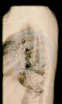 X-ray lumbo-sacral spine and pelvis. Examination scan
