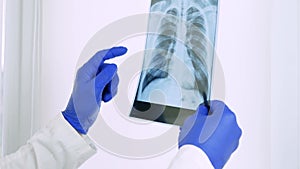 X-ray of the lungs in the hands of the doctor,the attending physician points his finger at the X-ray of the lungs to study the dis