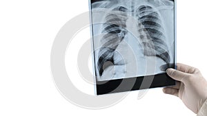 X-ray of the img