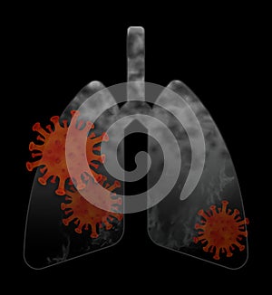 X ray of lungs with red virus inside