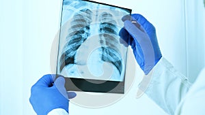 X-ray of the lungs to look at the light,the doctor is carefully examining the diagnosis,close-up